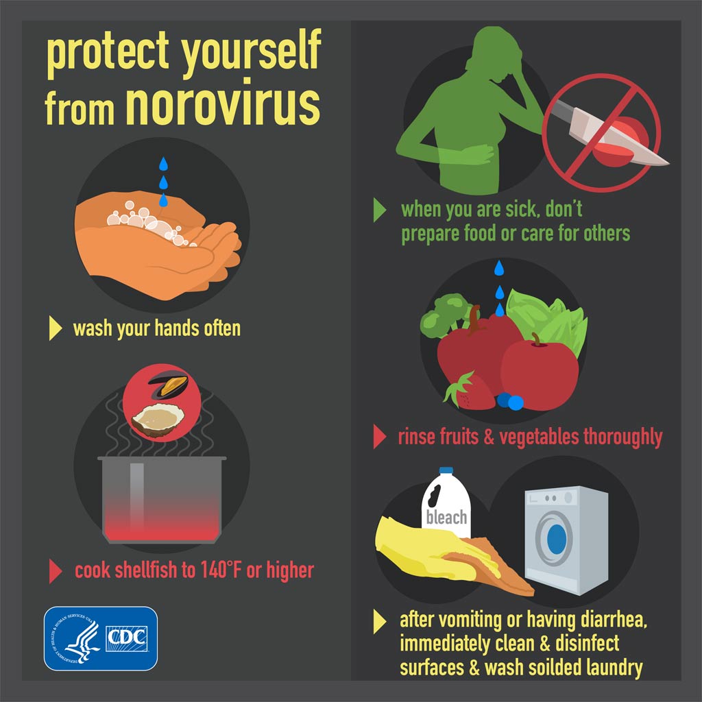 Norovirus Infections How Can I Stay Safe 